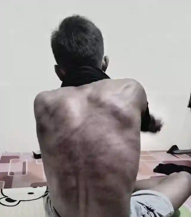 Warga Jonggon Dianiaya, Kapolda Kaltim: Tidak Ada Penyelesaian di Bawah Tangan