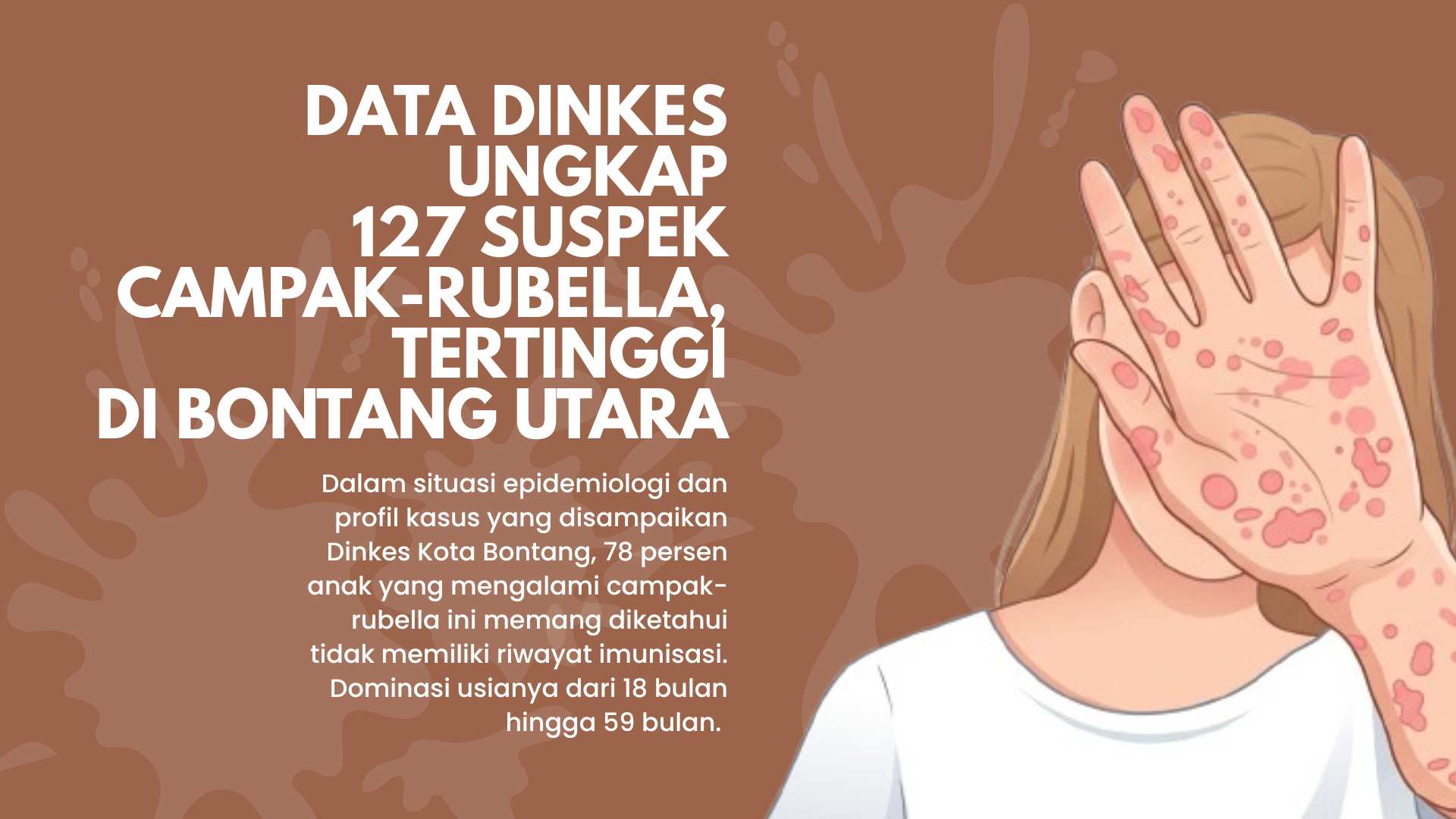 Data Dinkes Ungkap 127 Suspek Campak-Rubella, Tertinggi di Bontang Utara