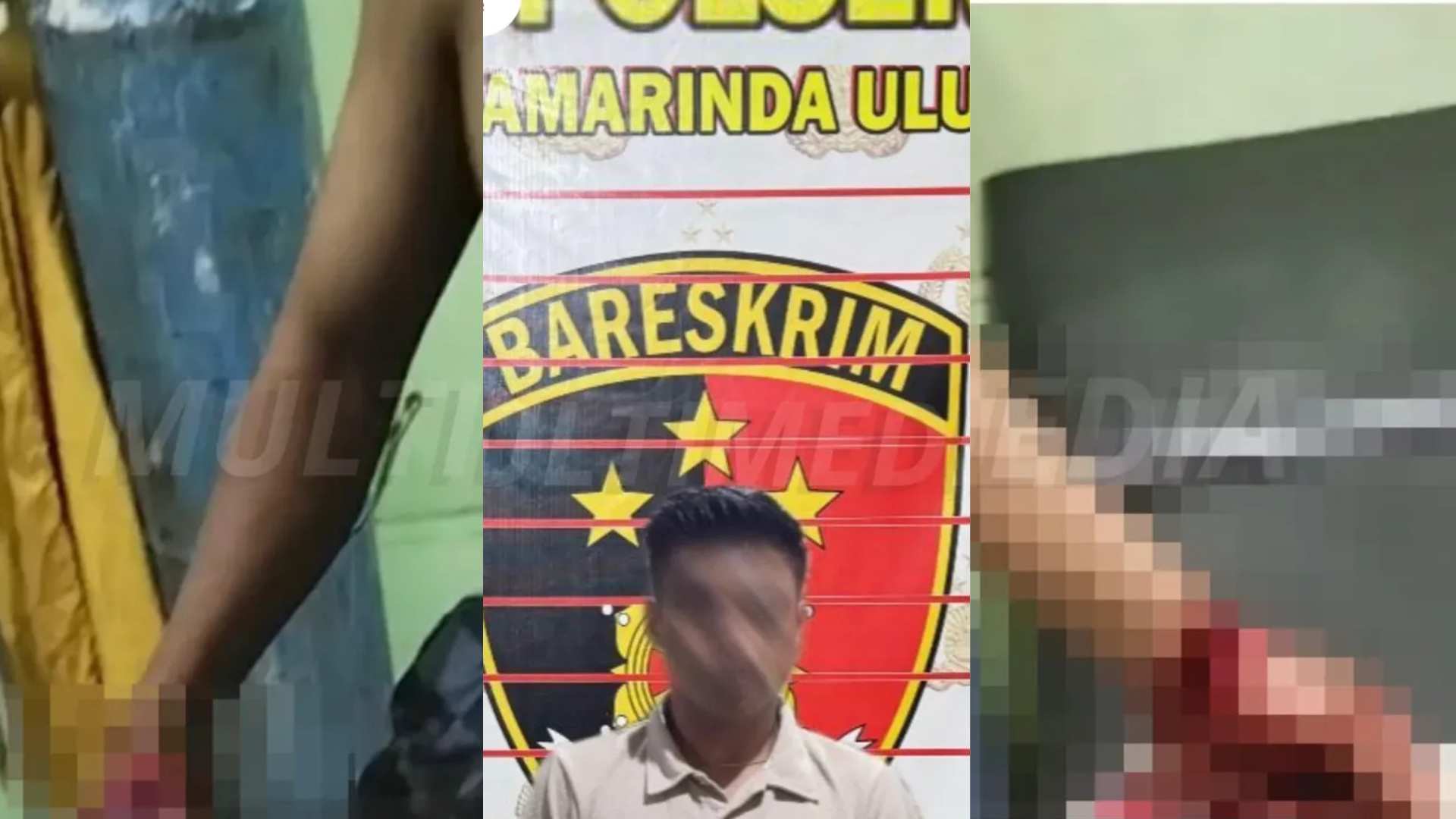 Tangan Ditebas saat Bantu Rapikan Barang, Pelaku Diamankan di Jalan M. Said Samarinda