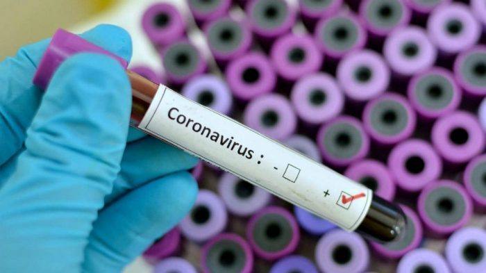 Universitas Airlangga dan Eijkman Ditunjuk Jadi Lab Tes Virus Corona